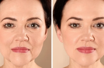 Що заборонено робити після біоревіталізації: рекомендації та поради