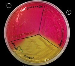 Шляхи передавання Staphylococcus aureus: як інфекція поширюється й передається