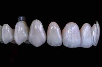 Скільки коренів має зуб: всі деталі про різні типи зубів