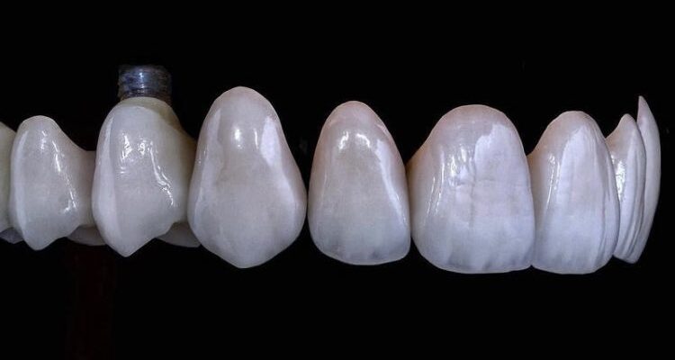 Скільки коренів має зуб: всі деталі про різні типи зубів Скільки коренів має зуб: всі деталі про різні типи зубів