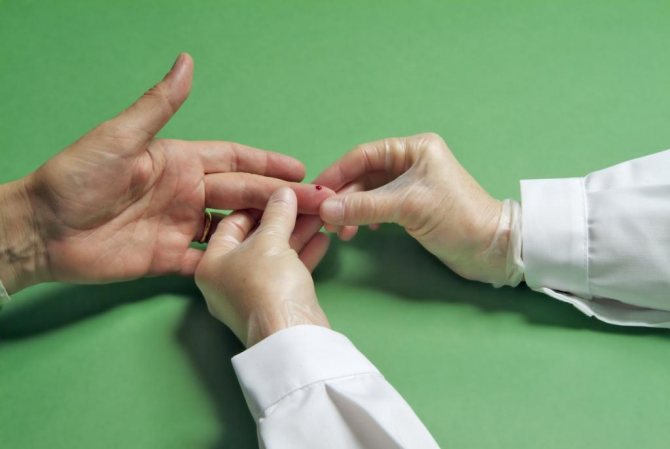 Навіщо сниться здавати аналіз крові з пальця