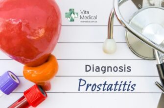 Ускладнення після біопсії простати: що важливо знати пацієнтам