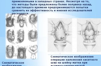 Вагітність: оптимальна довжина шийки матки для здорового перебігу