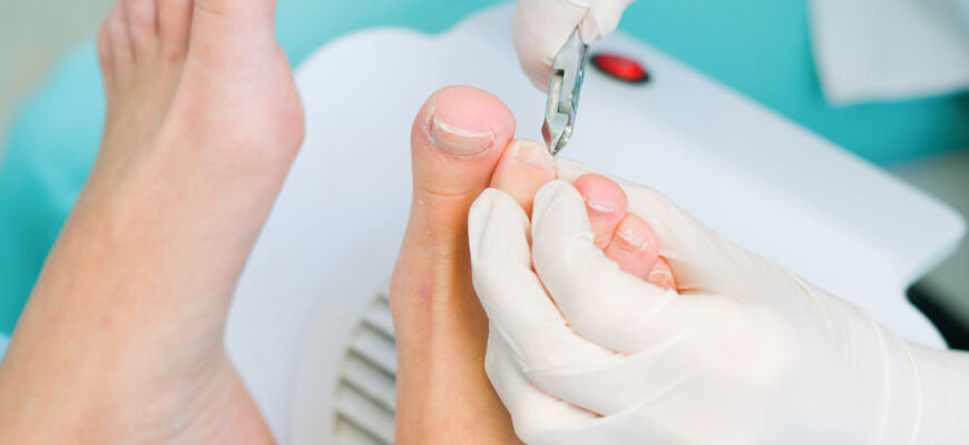 Як відростає ніготь після видалення: основні етапи та поради догляду