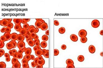 Якого кольору має бути кал: норма та можливі зміни кольору стулу