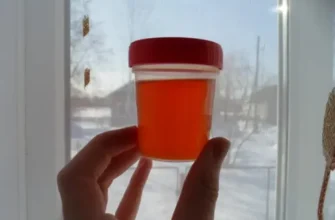 Який колір сечі є нормальним: відповіді на поширені запитання