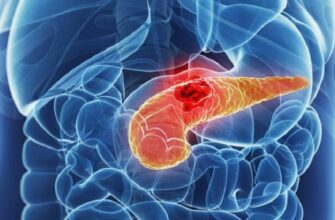 З якого боку болить підшлункова: виявляємо джерело болю ефективно
