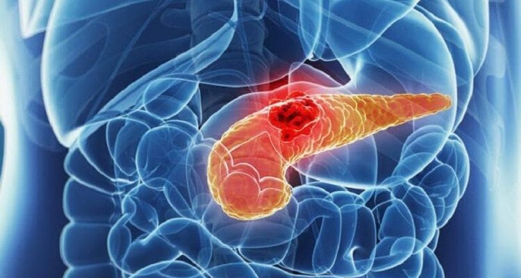 З якого боку болить підшлункова: виявляємо джерело болю ефективно