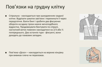 Як надійно закріпити пов’язку: покрокове керівництво з фото