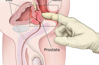 Ефективний масаж простати вдома: покрокова інструкція для чоловіків