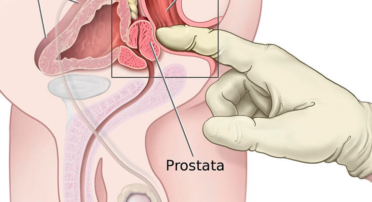 Ефективний масаж простати вдома: покрокова інструкція для чоловіків