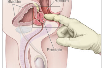 Як правильно та безпечно виконувати масаж простати вдома: покрокова інструкція