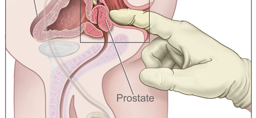 Як правильно та безпечно виконувати масаж простати вдома: покрокова інструкція