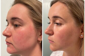 Як зробити виразні скули вдома: прості поради та вправи