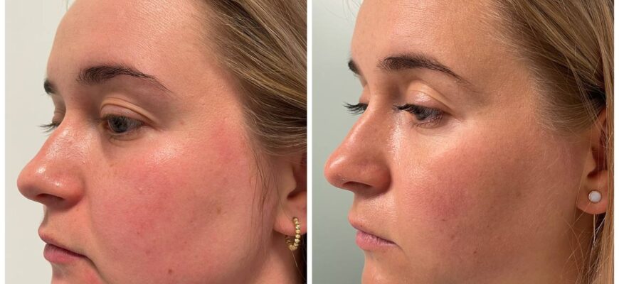 Як зробити виразні скули вдома: прості поради та вправи