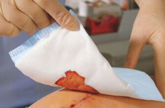 Як правильно зробити перев’язку вдома: покрокова інструкція та поради
