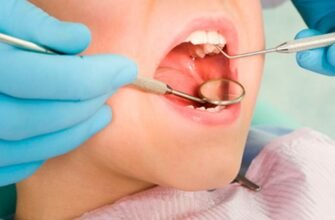 Лікування зубів у дітей: чому молочні зуби не залишають на потім